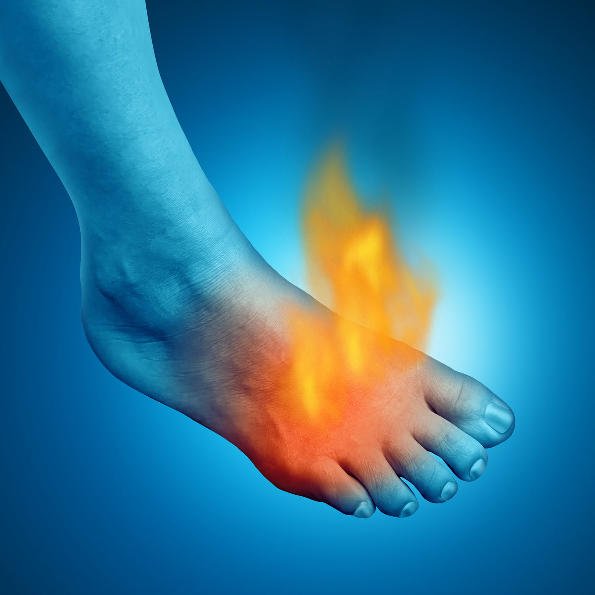 Sensation de brûlure PodiaPro